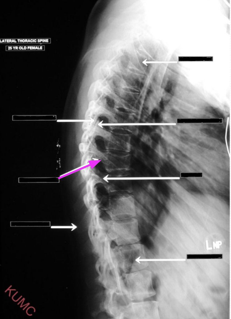 <p>What structure is referenced by the arrow highlighted in pink?</p>