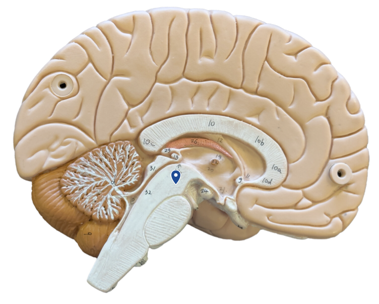 <p>What structure is the arrow pointing to?</p>