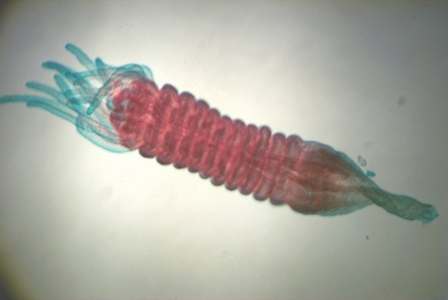 <p>- scyphistoma undergoes a process called strobilation, where it segments transversely</p>