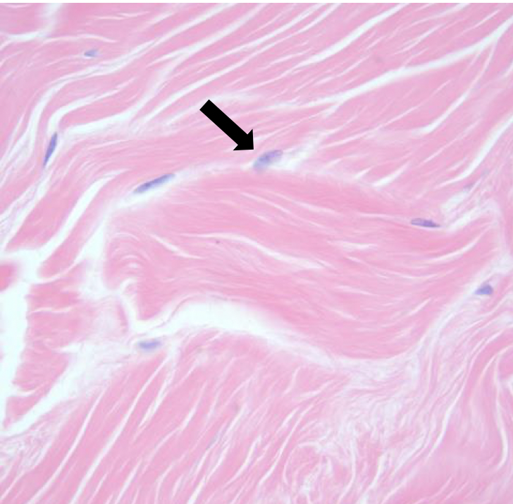 <p>What is the arrow pointing at and what is the cell type?</p>