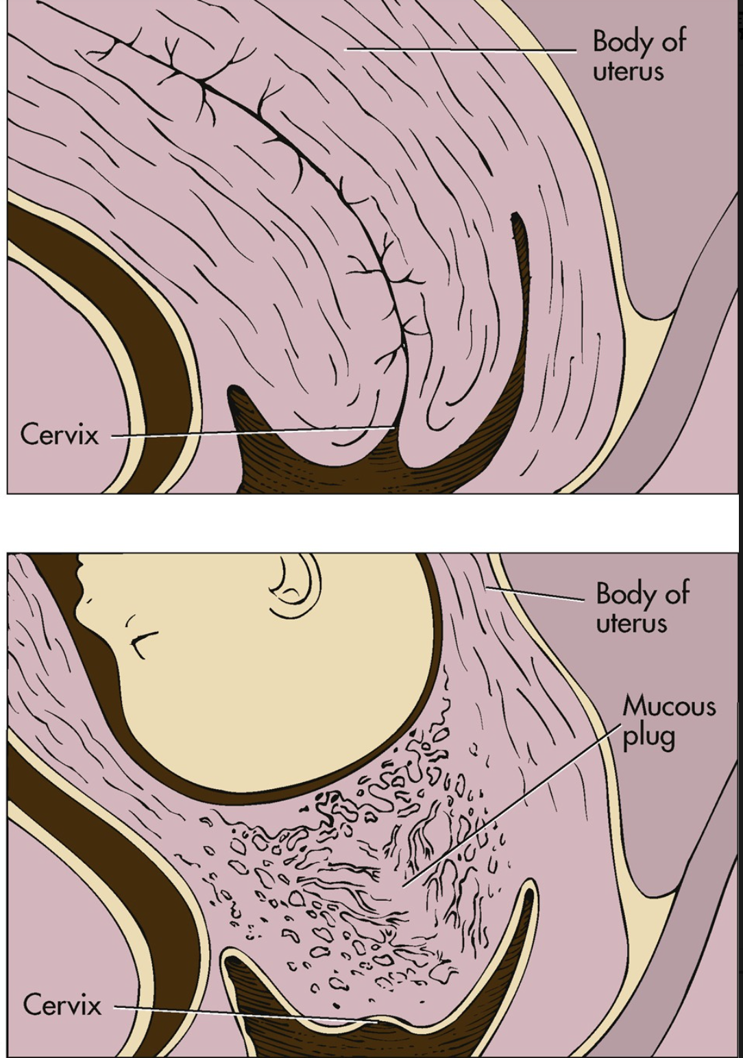 <p>muscous plug. mucus is rich in immunoglobulins and acts as a barrier against bacterial invasion of the uterus</p>