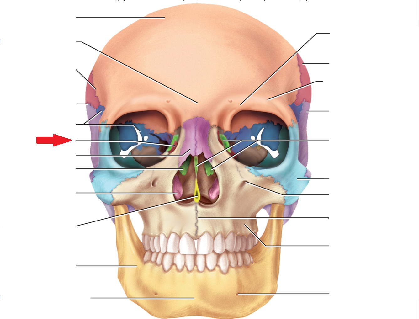 term image