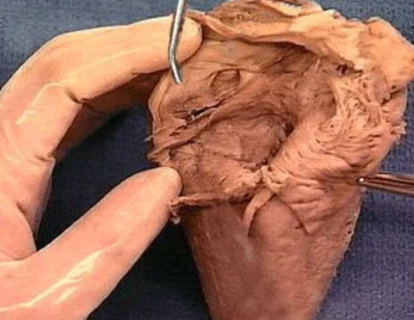 <p>Smooth part of right atrium</p>