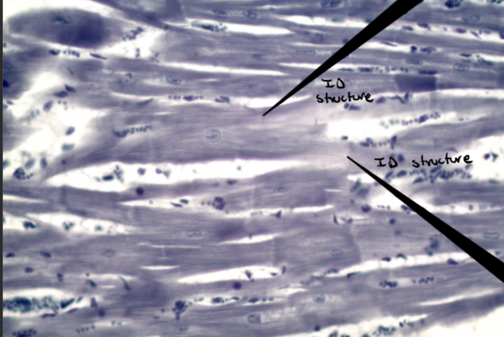 <p>Identify this image </p>
