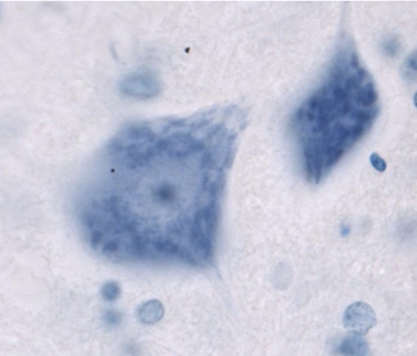 <p>grūdėtasis endoplazminis tinklas+ribosomos.</p>