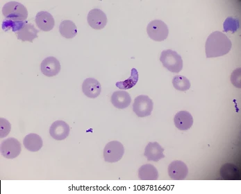 <p>in humans and primates/birds</p><p>fever, regular synchronous paroxysms, coma, convulsions</p><p>SE Asia, South America, Africa</p>
