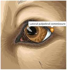 <p>The outer corner of the eye where the eyelids meet</p>