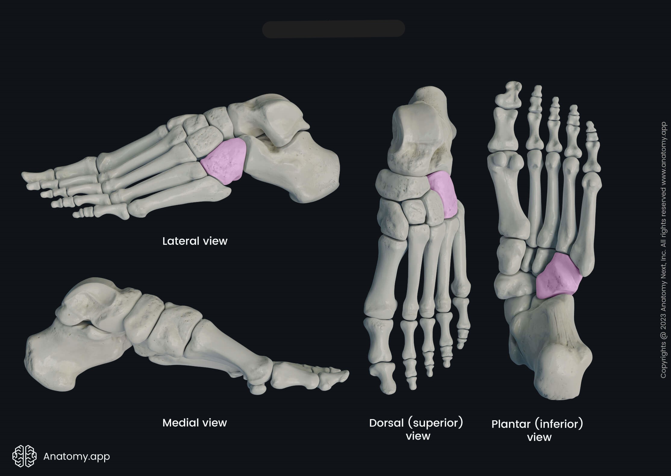 <p>What bone is this?</p>