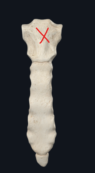 <p>What is this called? (X)</p>