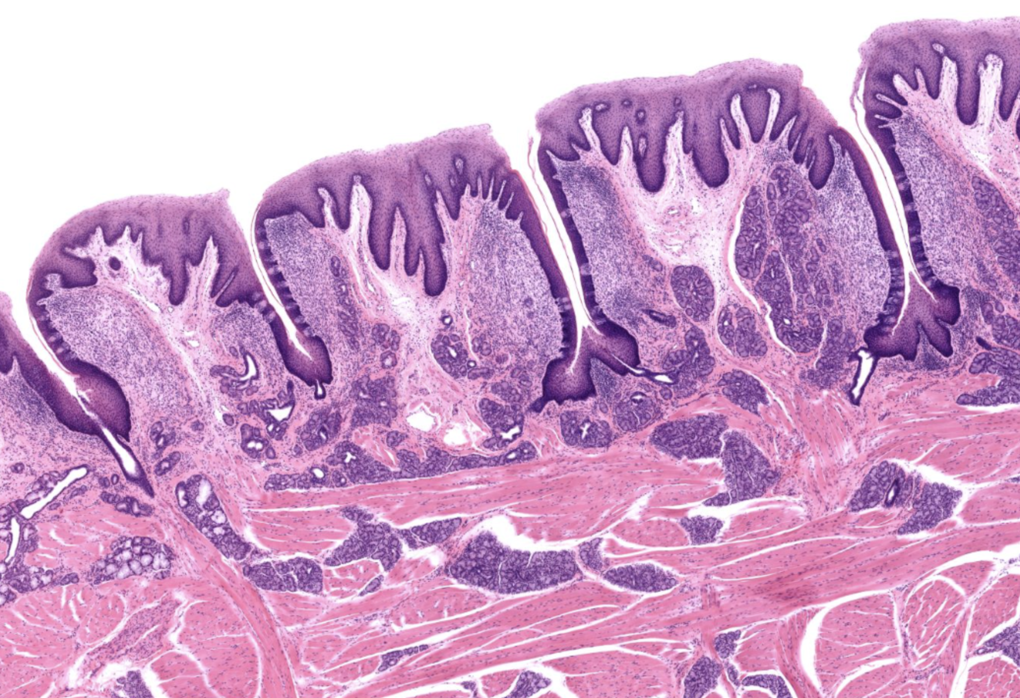 <p>Foliate Papillae in Tongue</p>