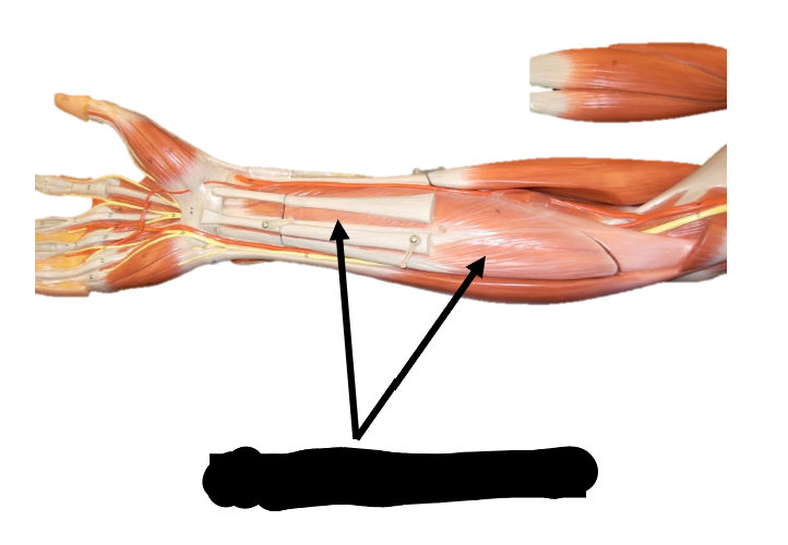 <p>Origin: medial epicondyle of humerus</p><p>Insertion: both sides of the middle phalanges</p><p>Function: flexes fingers</p>