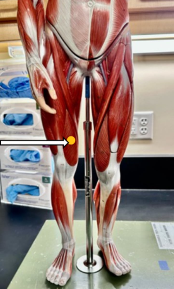 <p>vastus medialis (function)</p>