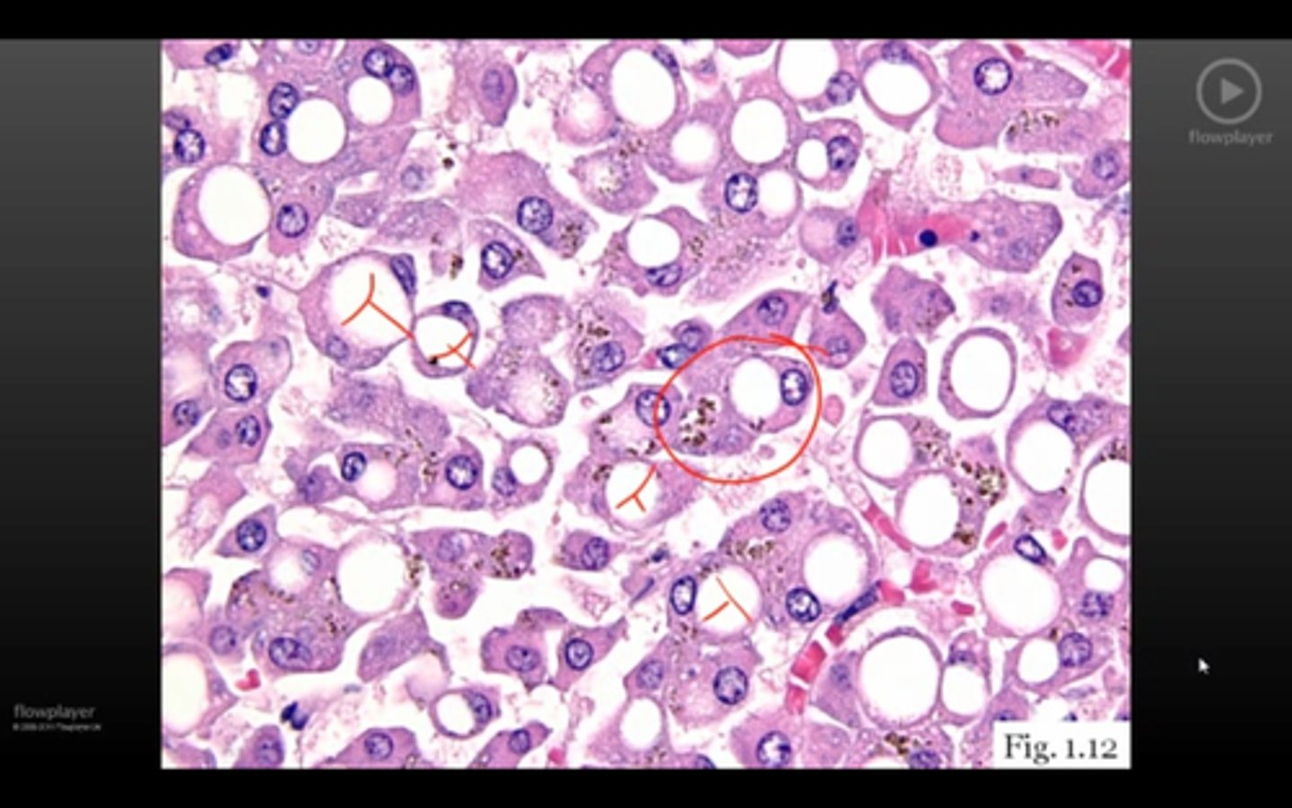 <p>liver histo</p>