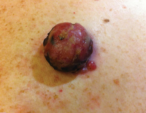 <p>Hoe heet dit klinisch beeld? </p>