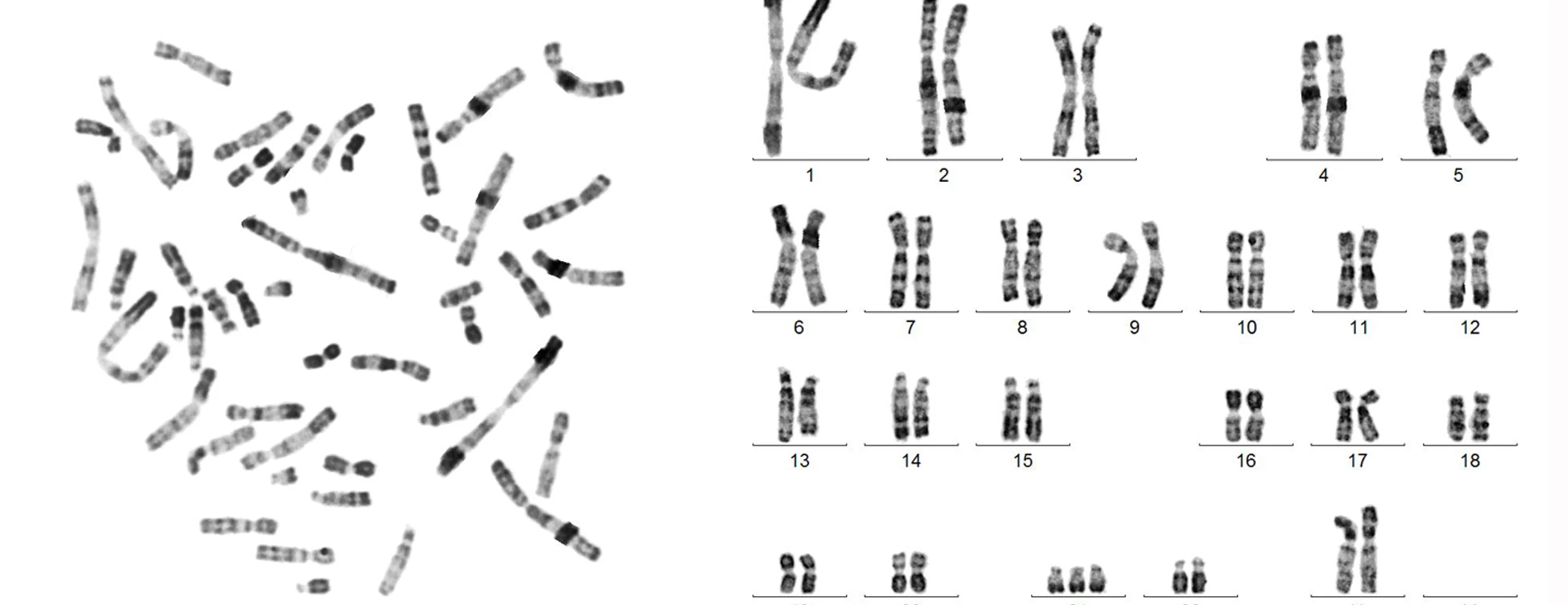 <p>a visual representation of homologous pairs of chromosomes </p>
