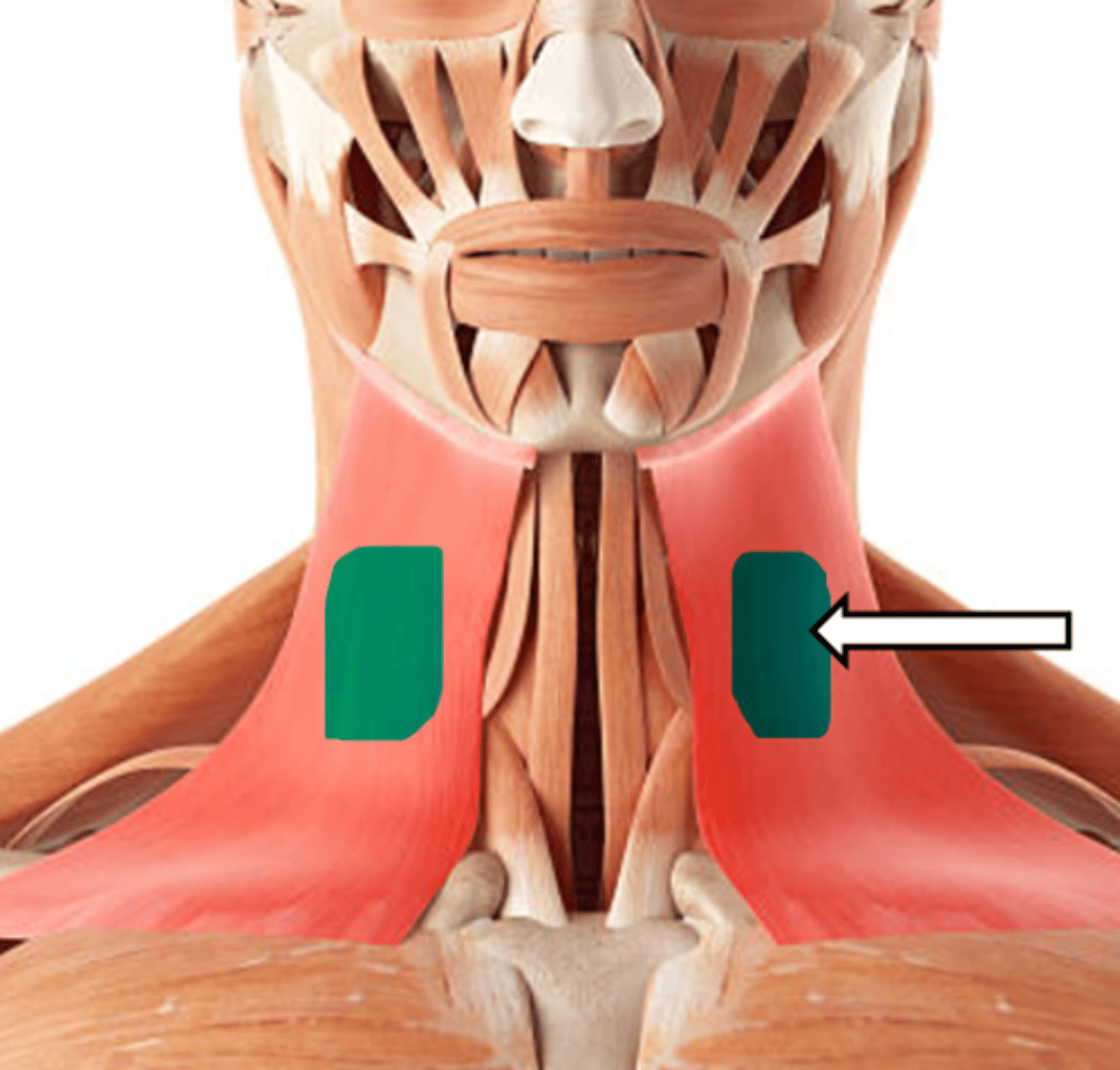 <p>name the muscle</p>