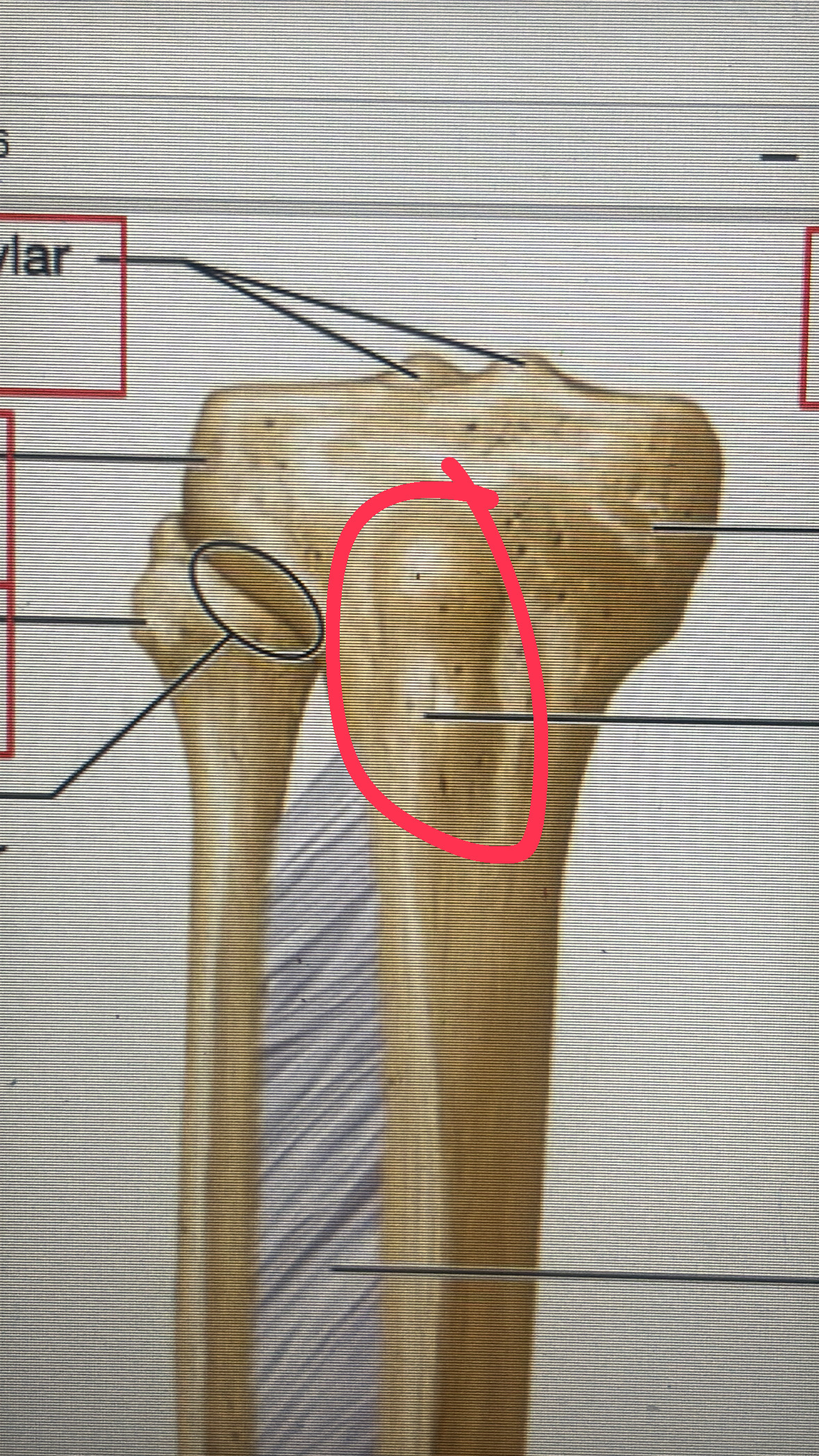 <p>the epiphysis bump of the tibia</p>