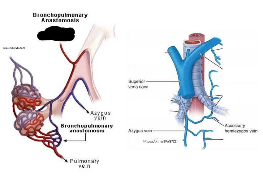 <p>What Artery is this?</p>