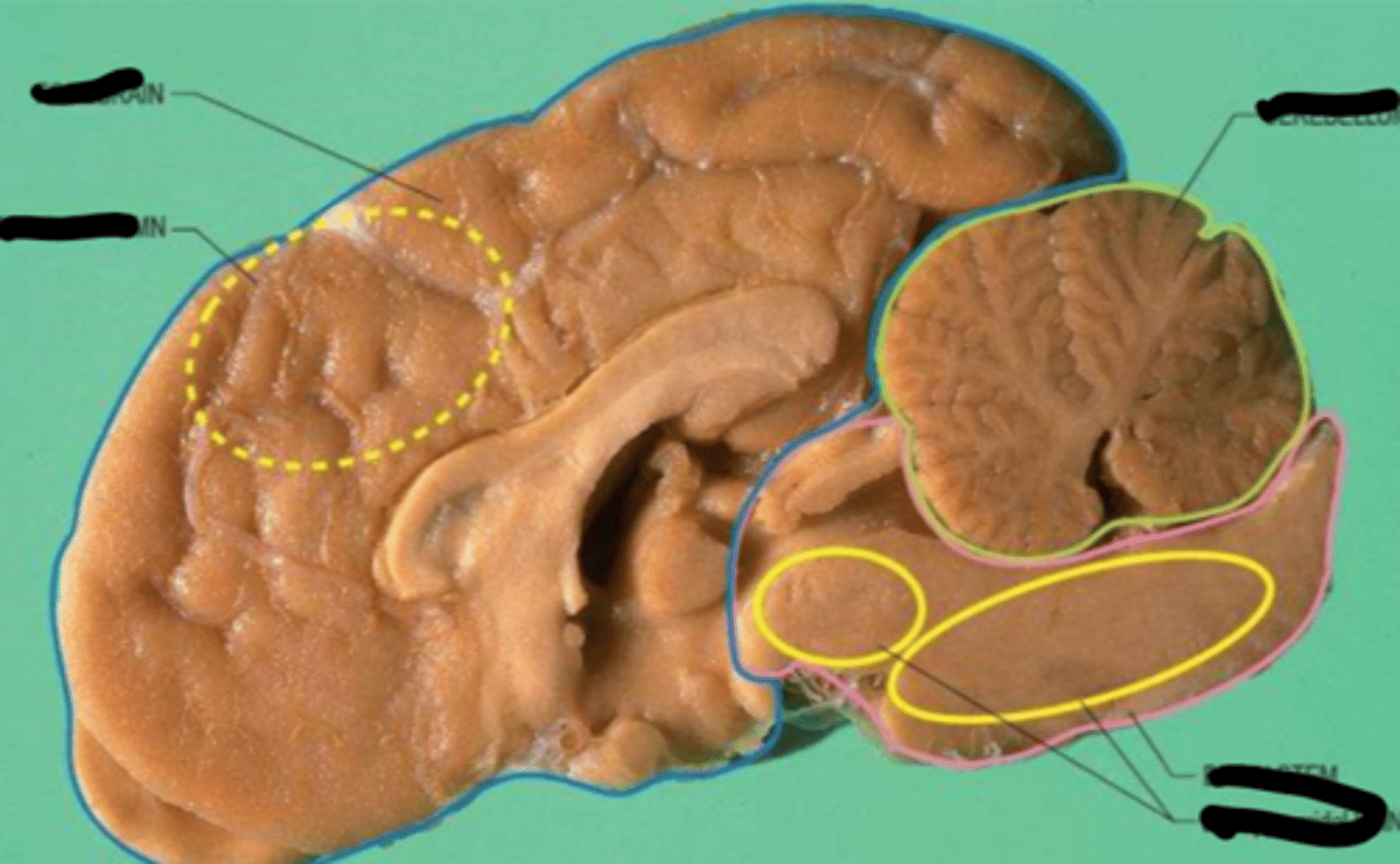<p>Projections from the brainstem nuclei</p>