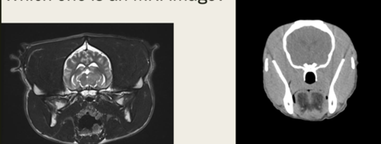 <p>which one is the CT and which is the MRI?</p>