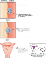 blastocyst