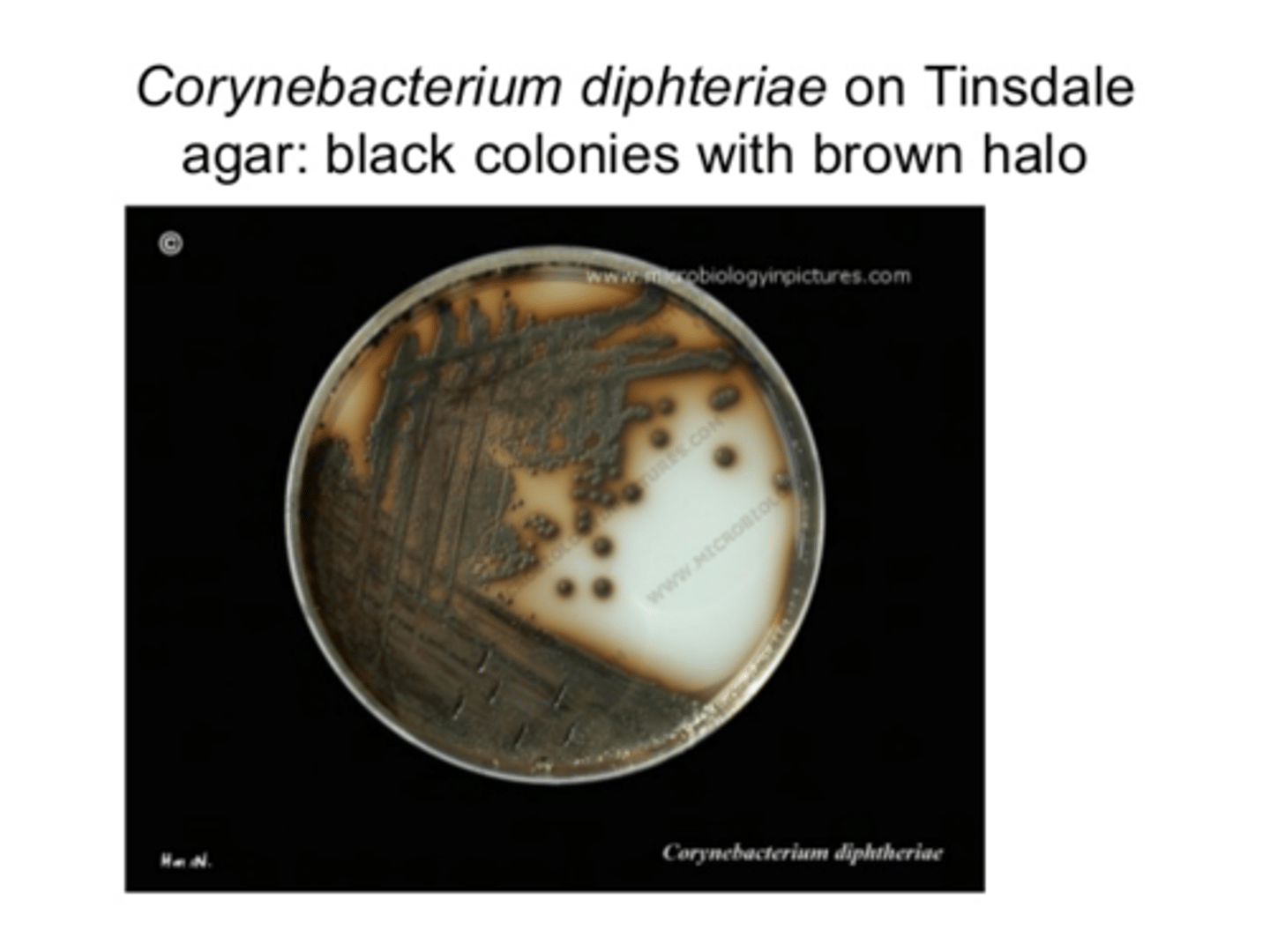 <p>Tindale agar</p>
