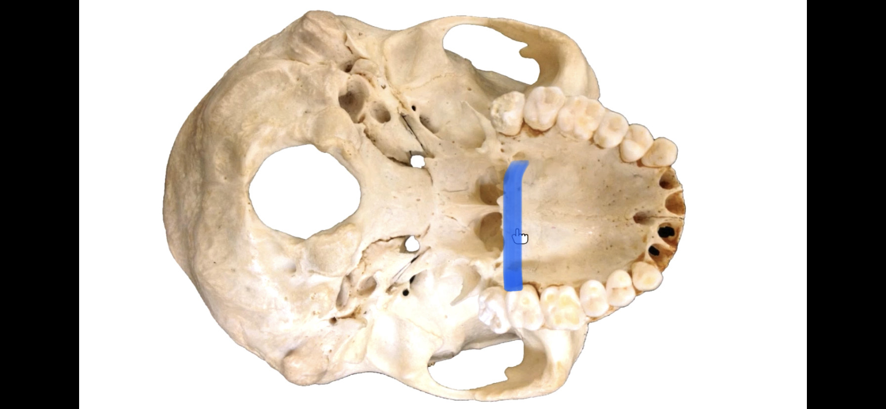 back of roof of mouth 