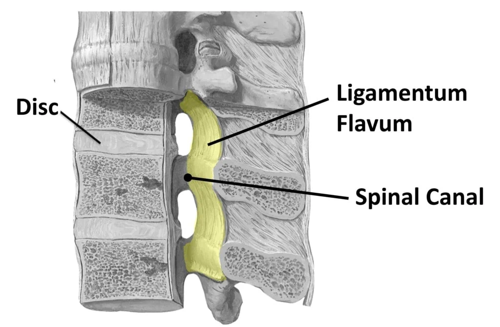 <p>flaval (yellow) ligament</p>
