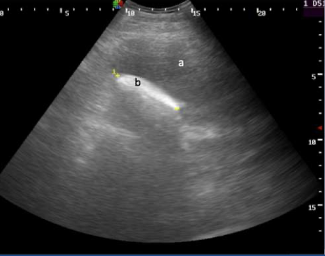 <p>What is this showing?</p>