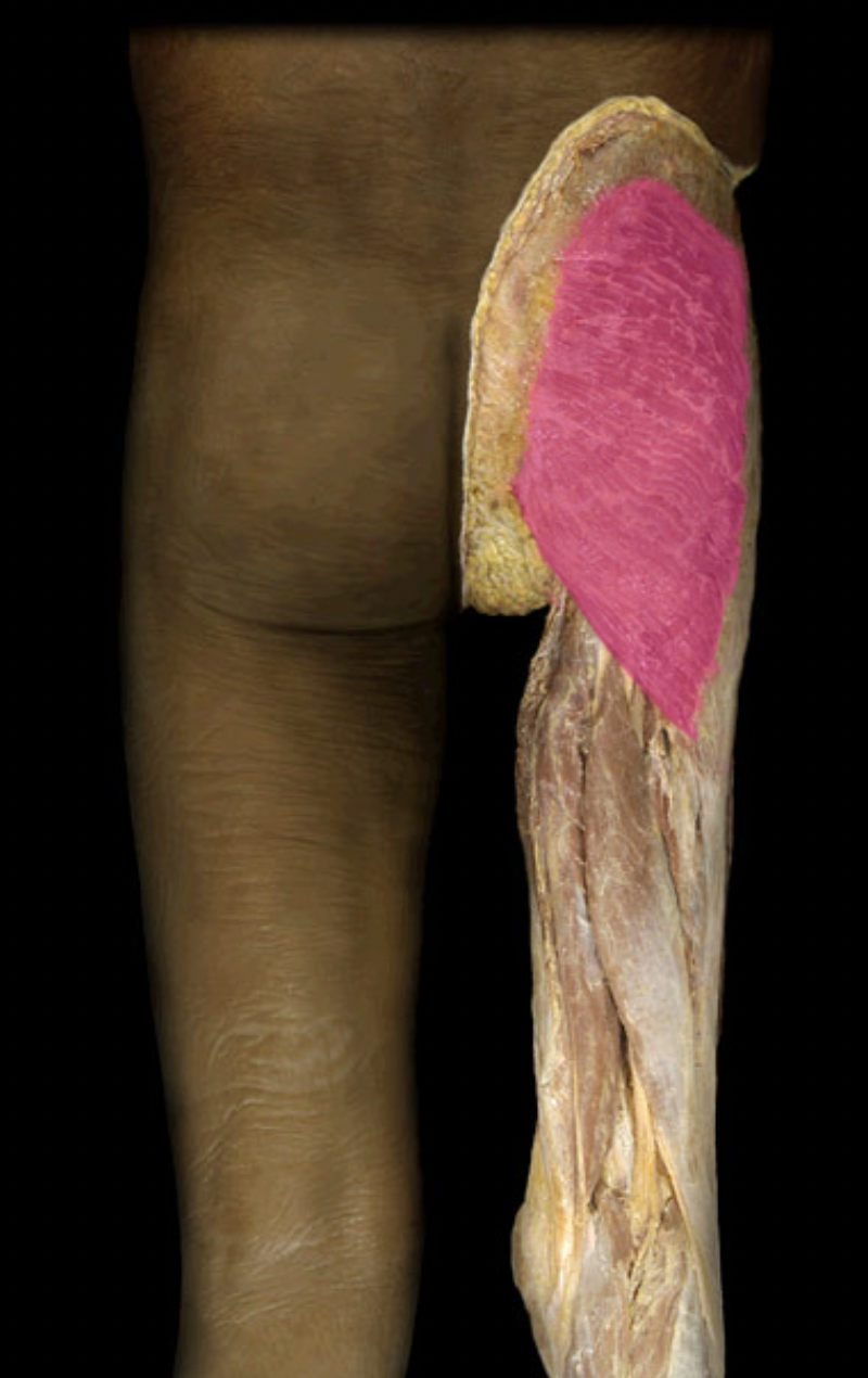 <p>Gluteus maximus m. (innervation)</p>