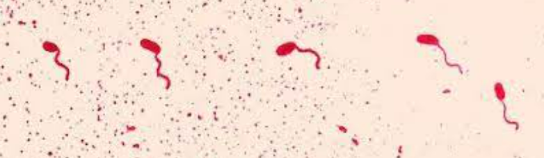 <p>Type of flagella</p>