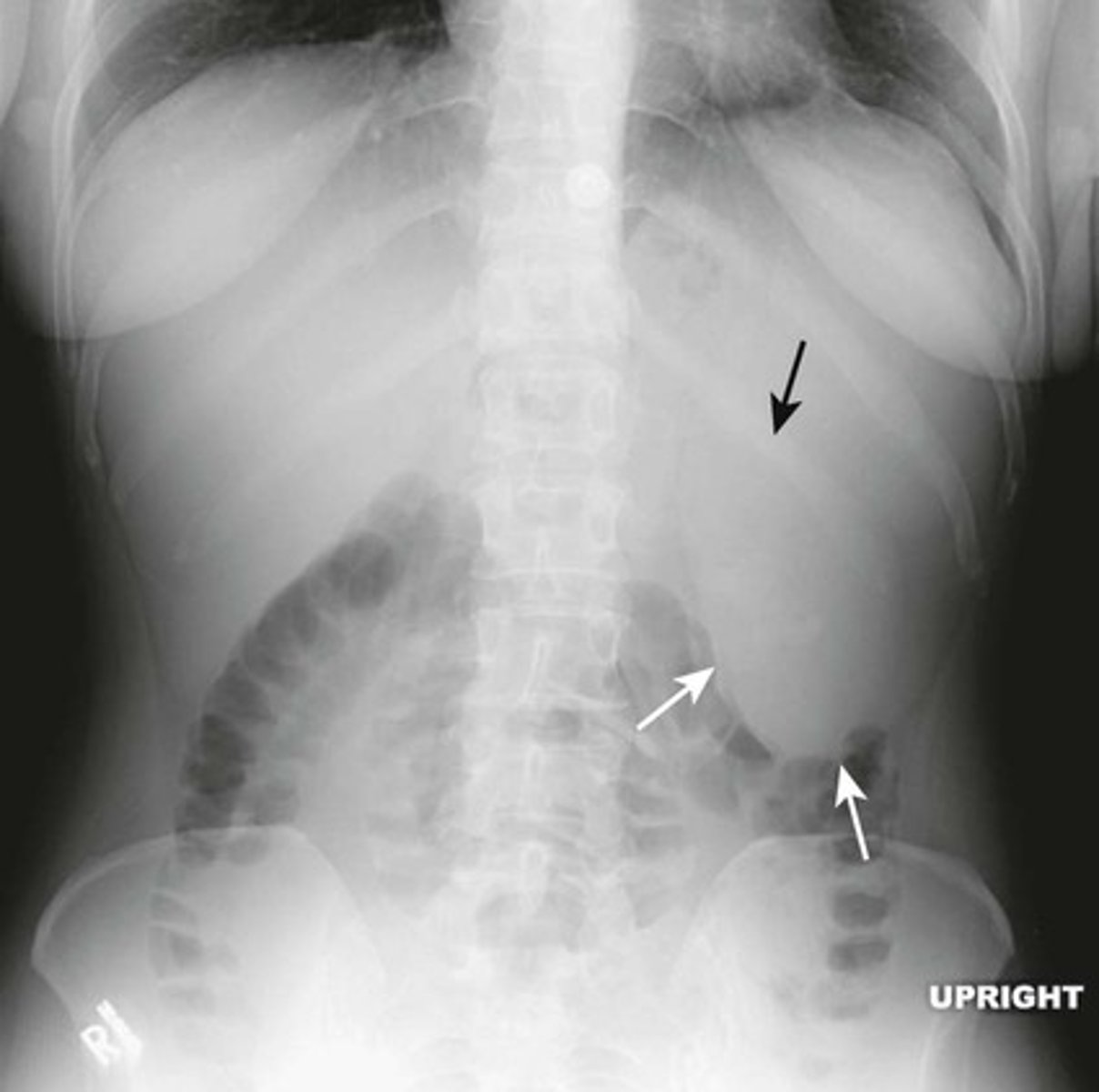 knowt flashcard image