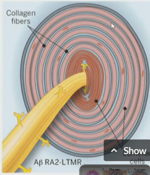 <p>type of surrounding capsule, has collagen fibers</p>