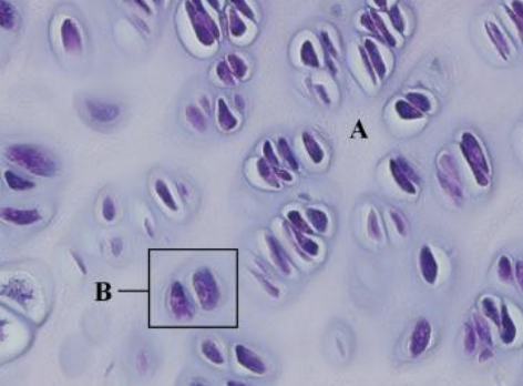 <p>what is b?</p>