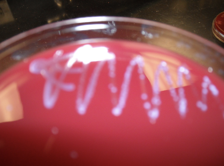 <p>What type of plate is this, and what is the purple?</p>