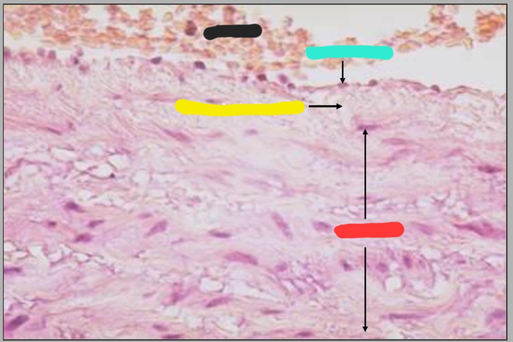 <p>What are the parts that can be seen in this slide of Tunica intima and tunica media of aorta?</p>