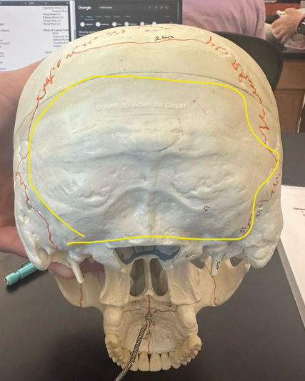 <p>What is circled in yellow?</p>