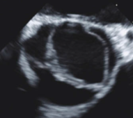 <p>Identify this image. </p>