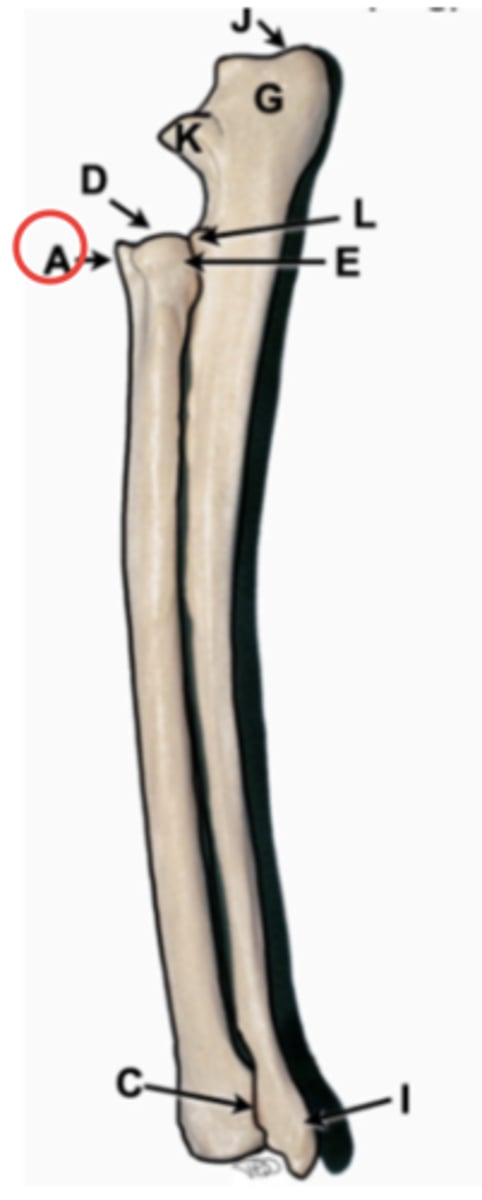 <p>proximal aspect with concave articular surface that articulates with the humerus</p>