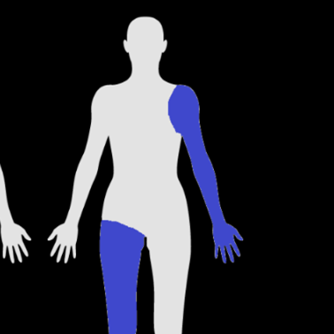 <p>Limbs opposite sides of the body </p>