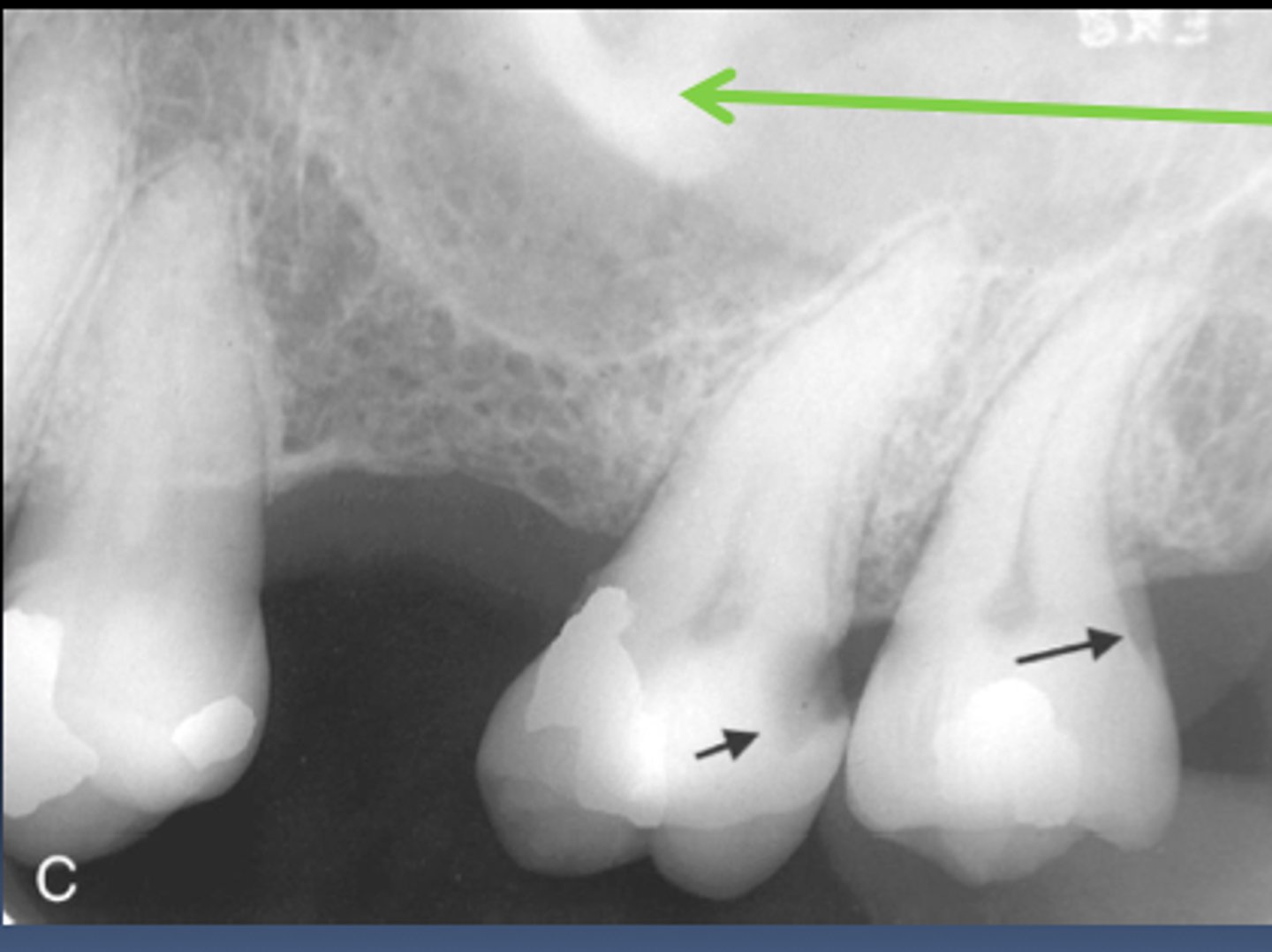 <p>Identify the radiopaque structure</p>