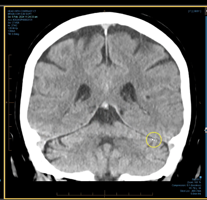 term image