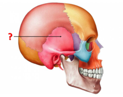 Identify this bone.