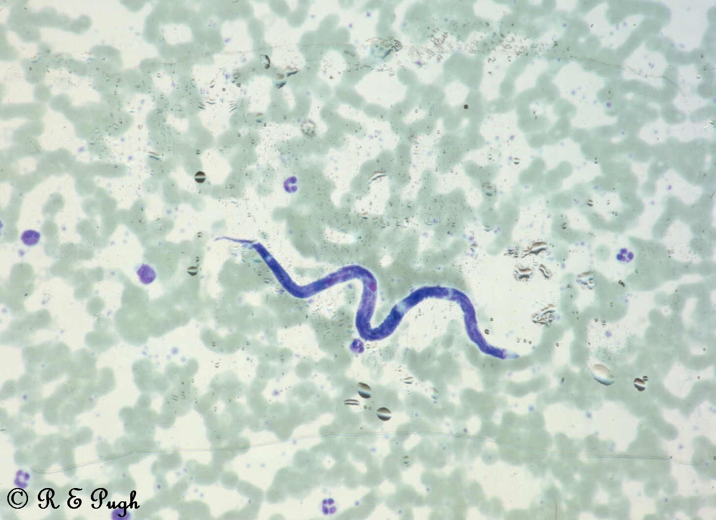 <p>in human blood</p><p>calabar swelling, eye worm</p><p>West, Central Africa</p>