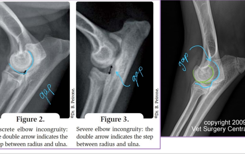 <p><span style="background-color: transparent;"><strong><span>Elbow Incongruity</span></strong></span></p>