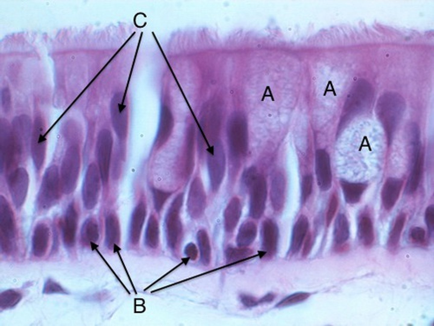 <p>Basal cells are involved in regeneration and repair of upper epithelial cell layers, ensuring epithelium continuity, integrity. </p><p>(B- in image)</p>