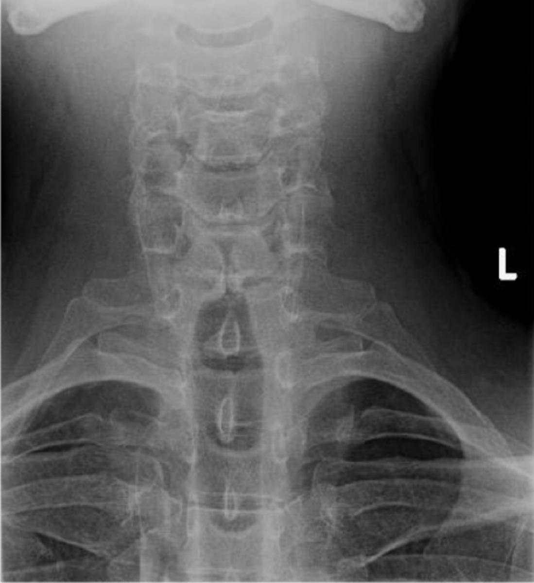 <p>ID abnormality</p>