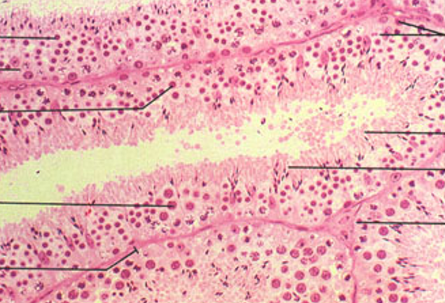 <p>Identify this structure</p>