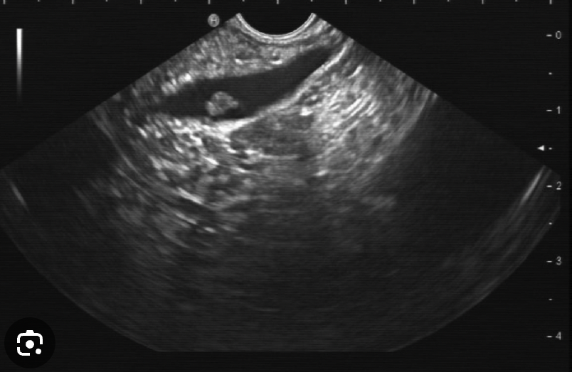 <p>What is Endosonography, what is it used for </p>