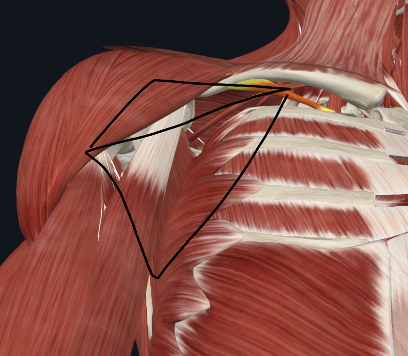 <p>Se estudia con el miembro superior en ADUCCIÓN COMPLETA y rotación externa</p><p>Sirve para el paso de la arteria y vena axilar. Plexo braquial.</p><p></p><p><mark data-color="yellow" style="background-color: yellow; color: inherit">Pared anterior: Pectoral mayor y menor</mark></p><p><mark data-color="blue" style="background-color: blue; color: inherit">Pared posterior: Escapular (Subescapular, redondo mayor, dorsal ancho)</mark></p><p><mark data-color="red" style="background-color: red; color: inherit">Interna: Serrato mayor</mark></p><p><mark data-color="purple" style="background-color: purple; color: inherit">Externa (solo en aducción): Brazo (Coracobraquial, bíceps)</mark></p><p><mark data-color="green" style="background-color: green; color: inherit">Base: Ligamento suspensorio de Gerdy (Aponeurosis profunda y superficial, Piel)</mark></p><p><mark data-color="#cf85dc" style="background-color: #cf85dc; color: inherit">Vértice: Músculo subclavio (clavícula, apófisis coracoides, primera costilla)</mark></p><p></p>